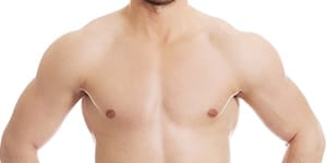 chest condition called pigeon chest