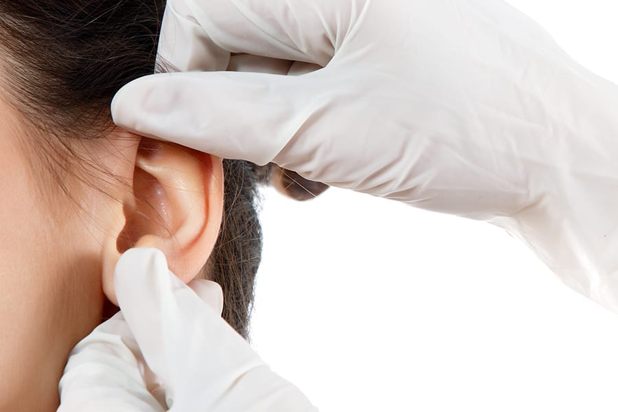 cosmetic ear surgey: ear setback